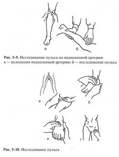 Пульс на периферических сосудах
