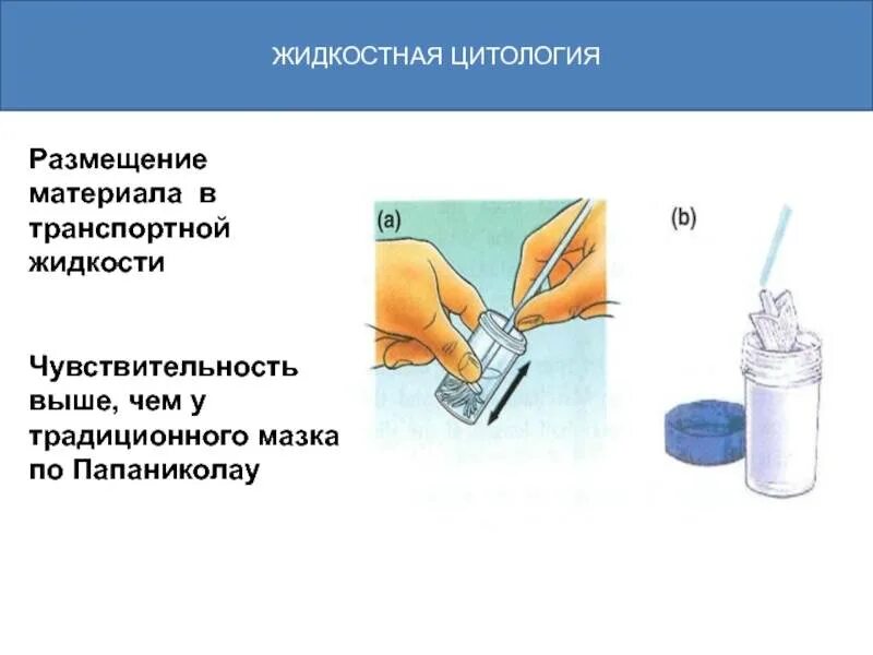 Пап тест жидкостная цитология. Взятие мазка на жидкостную цитологию. Мазок на жидкостную цитологию шейки матки. Исследование мазков методом жидкостной цитологии. Пап тест шейки