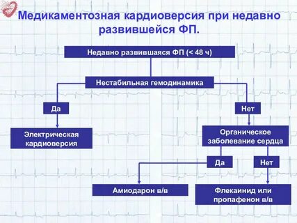 Кардиоверсия