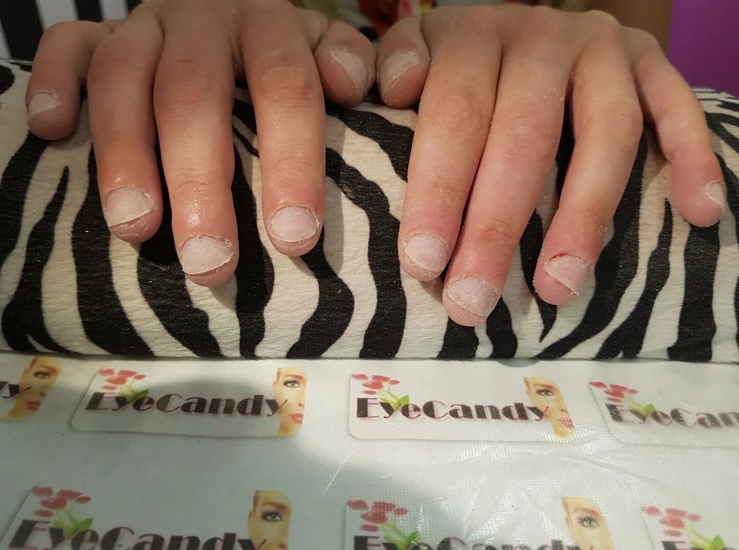 Ногти без маникюра не уходенные. Неудачный маникюр. Ужасные ногти на руках. Неудачный маникюр. Неудачный маникюр.