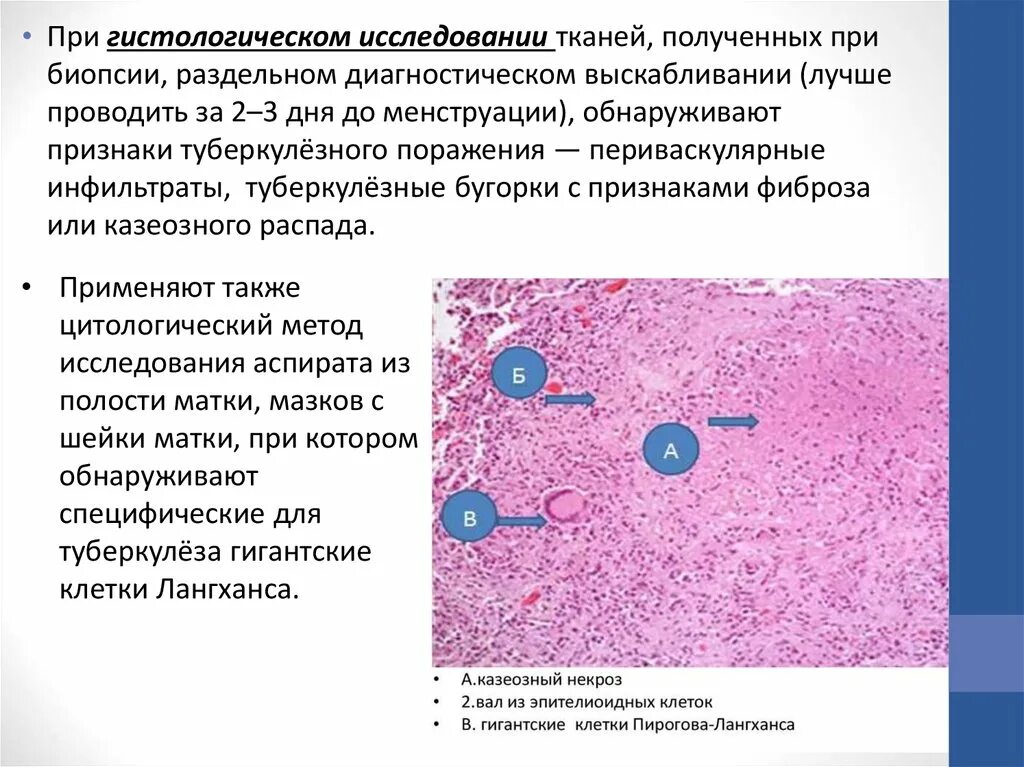 Цитологические и гистологические исследования. Гистологическое исследование при туберкулезе. Туберкулез гистология. Туберкулез гистологически. Гистологические методы исследования туберкулеза.