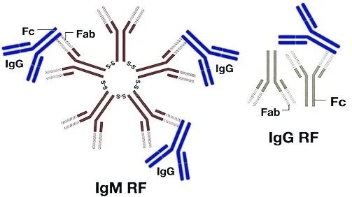 Рф фактор норма. Ревматоидный фактор IGM что это. Ревмофактор латекс тест. Латекс тест при ревматоидном. Ревматоидный фактор картинка.