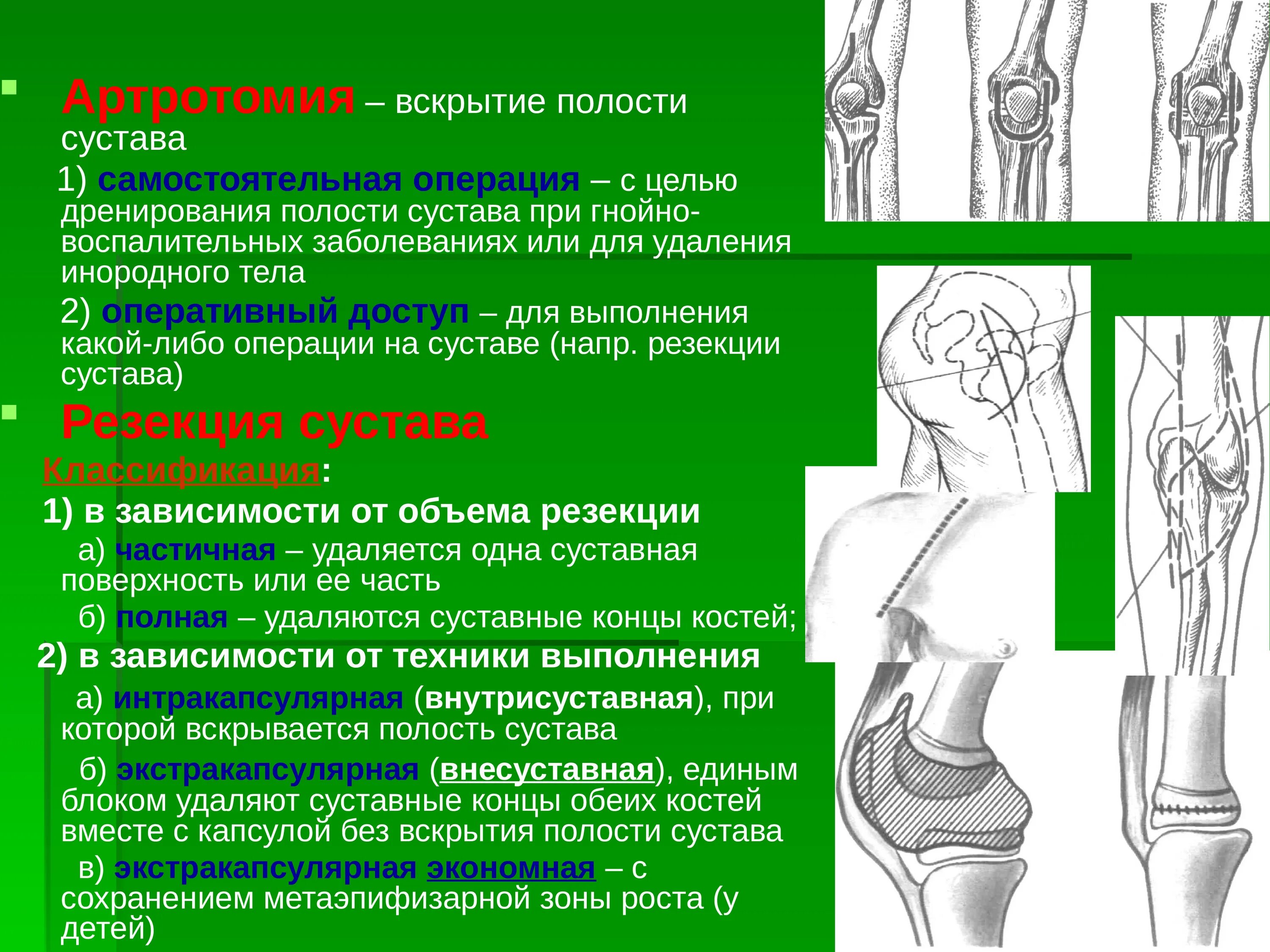 Заболевание костей и суставов название