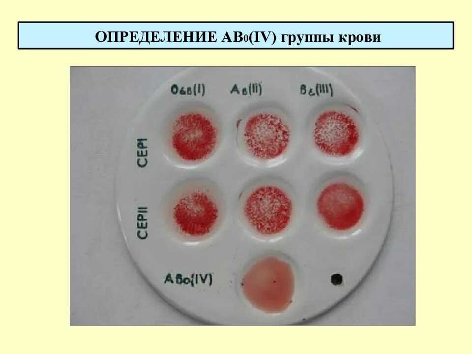 Белок определяющий группу крови. Ab0 группа крови. Ака определить группу крови. Какопрелелить группу крови. КВК опоеделять группу крови.