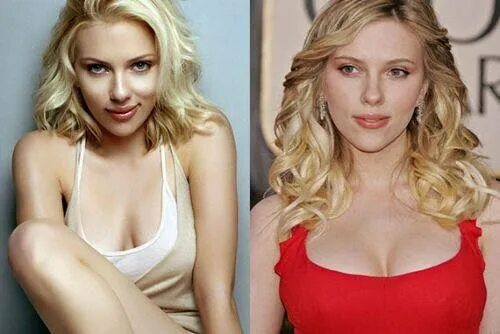 Scarlett Celebrity plastic surgery, Bad plastic surgeries, Celebrity surgery