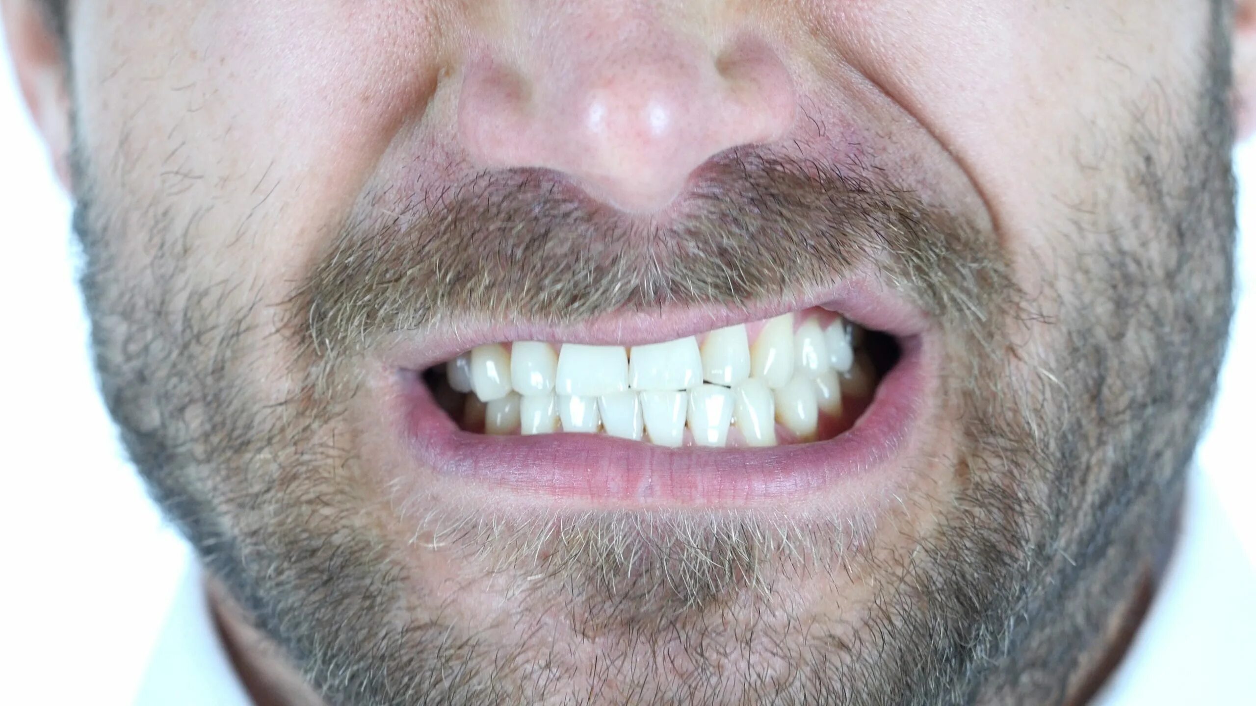 Зубы. Сильно сжатые зубы