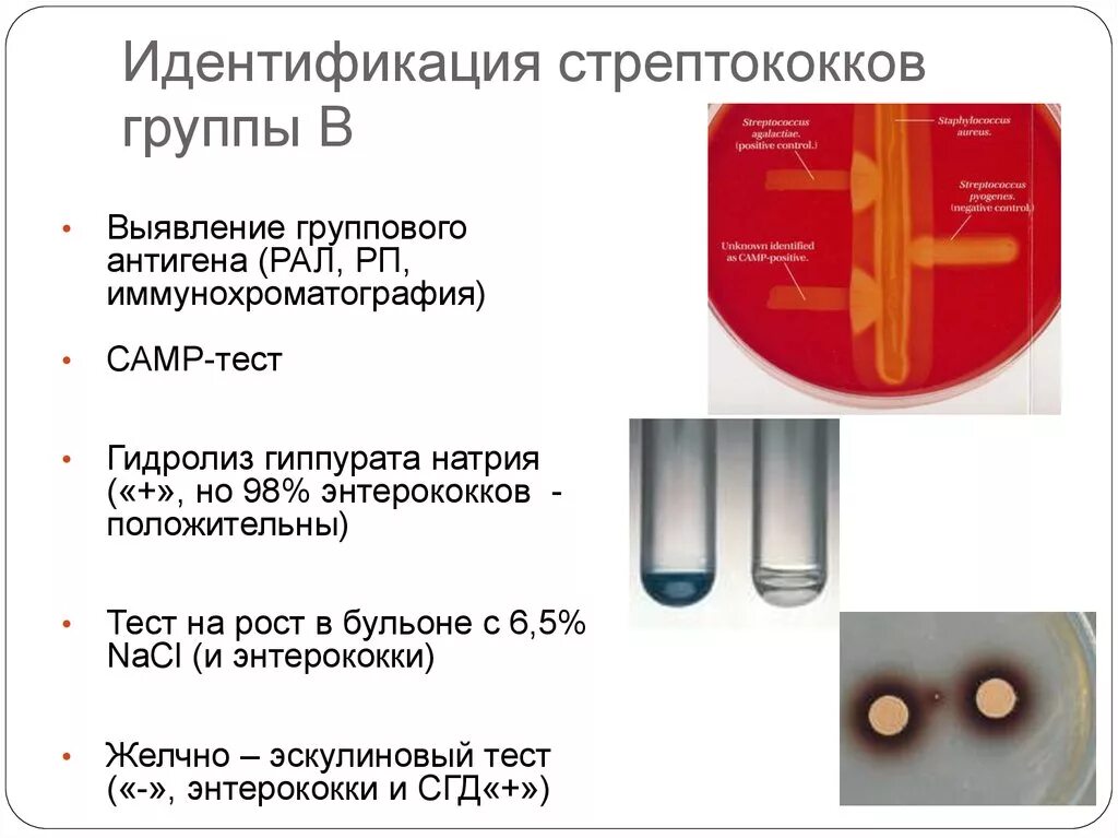 Посев на стрептококк а схема. Стрептококки серодиагностика. Дифференциация стрептококка от энтерококка. Стрептококки каталазоположительные. Тест стрептококк группы а