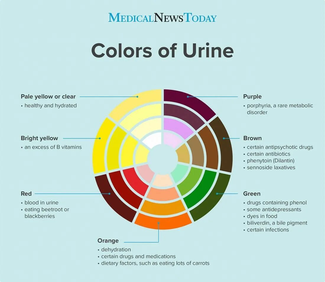 Какой цвет можно 2024. Различные оттенки мочи. Разные оттенки мочи. Urine Color. Разный цвет мочи.