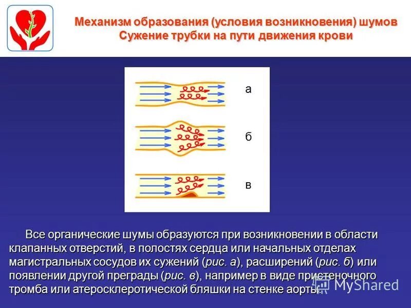 Причины появления шумов