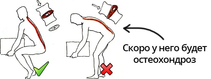 Сорвал спину
