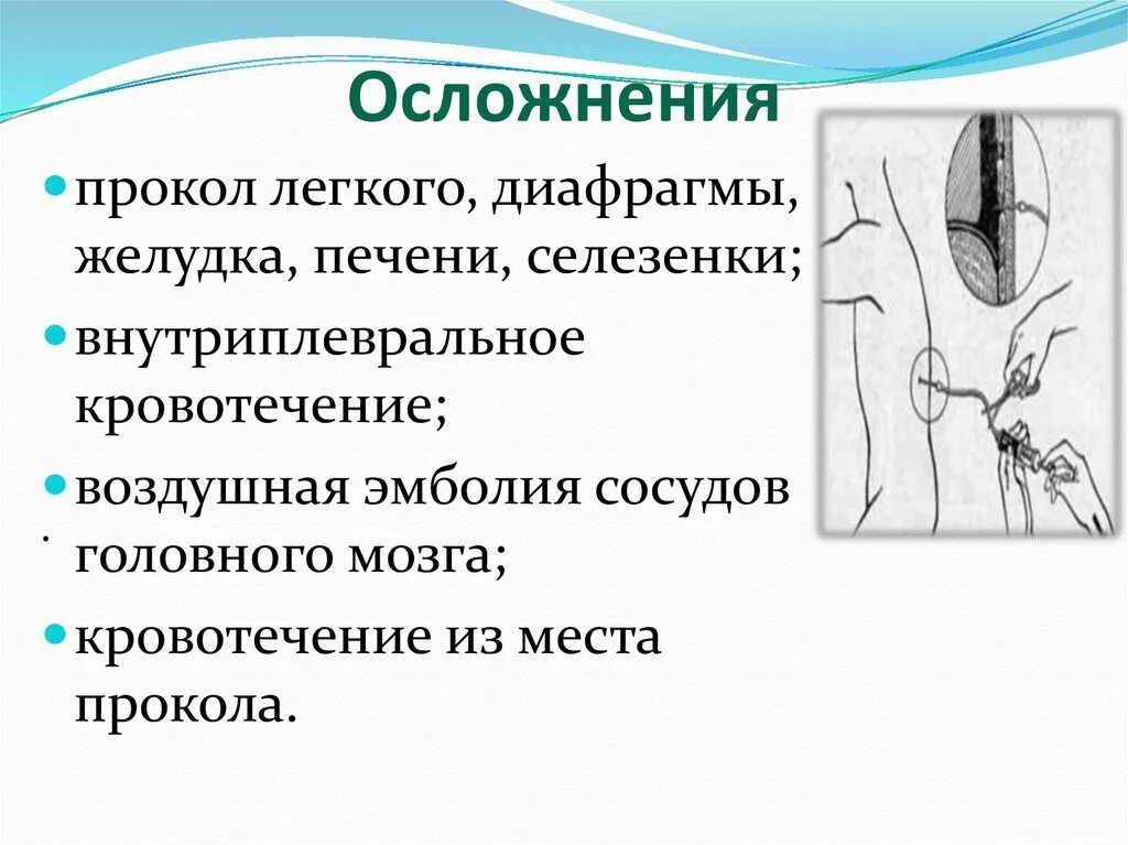 Возможные осложнения при выполнении стернальной пункции. Осложнения при плевральной пункции. Возможные осложнения люмбальной пункции. Возможные осложнения после люмбальной пункции. Осложнения после пункции