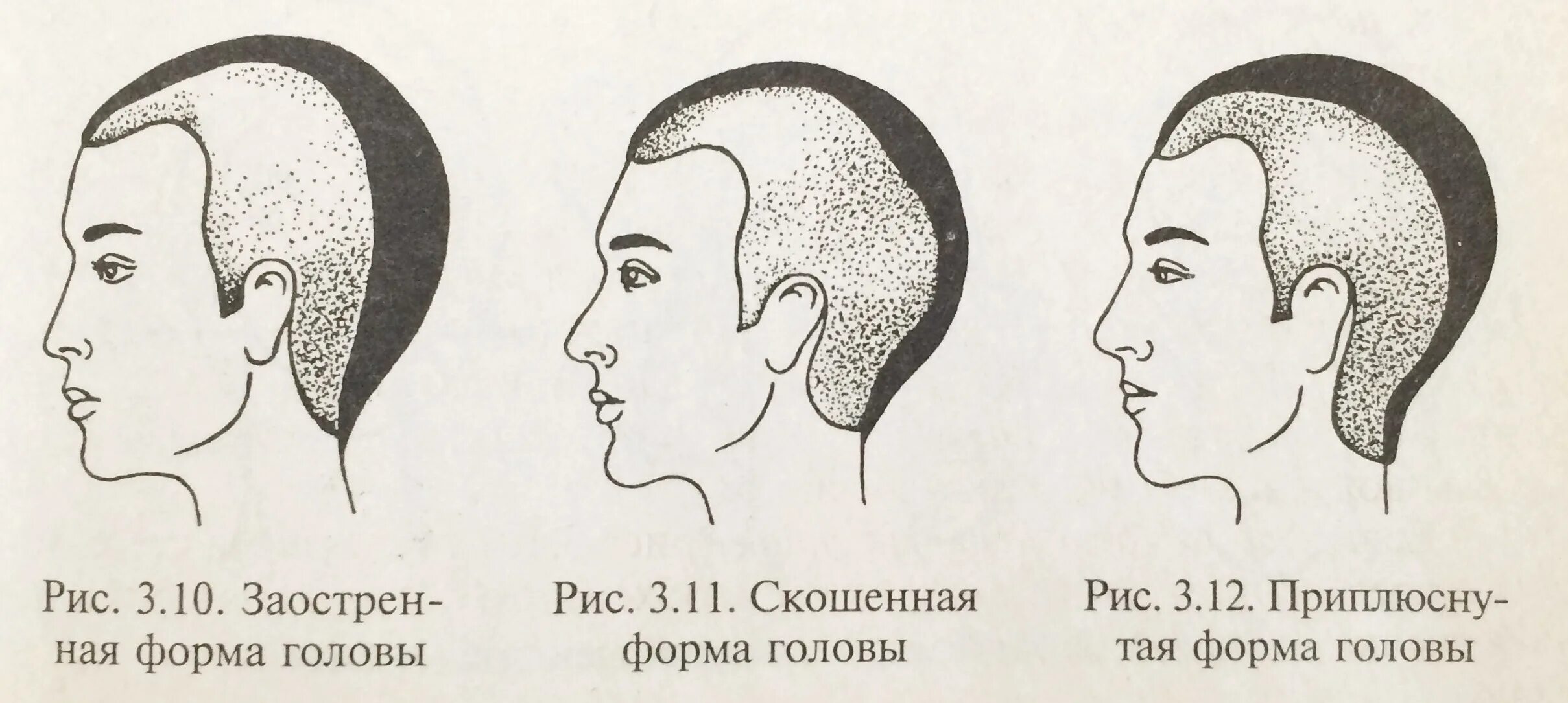 Форма затылка. Форма черепа человека сбоку. Праведная форма черепа. Правильная форма черепа.