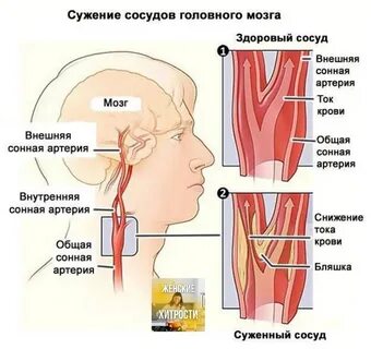Сосудистые для головного мозга
