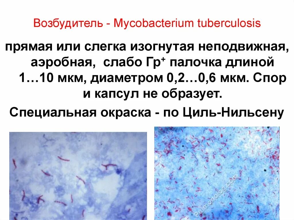 Туберкулез циль нильсену