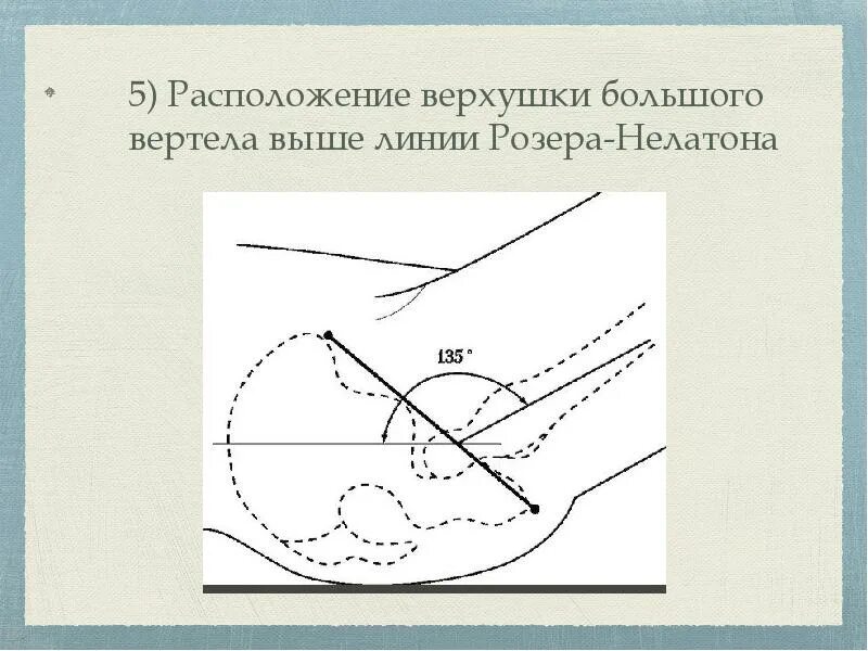 Располагающихся на верхушке