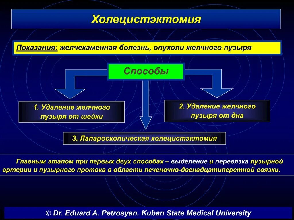 Холецистэктомия показания. Этапы операции холецистэктомии. Холецистомия показания. Открытая холецистэктомия показания.