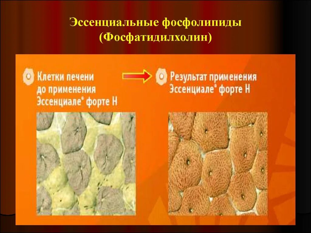 Фосфолипиды влияют на. Эссенциальные фосфолипиды уколы. эссенциальные фосфолипиды фармакология. механизм действия эссенциальных фосфолипидов. эссенциальные фосфолипиды для печени.
