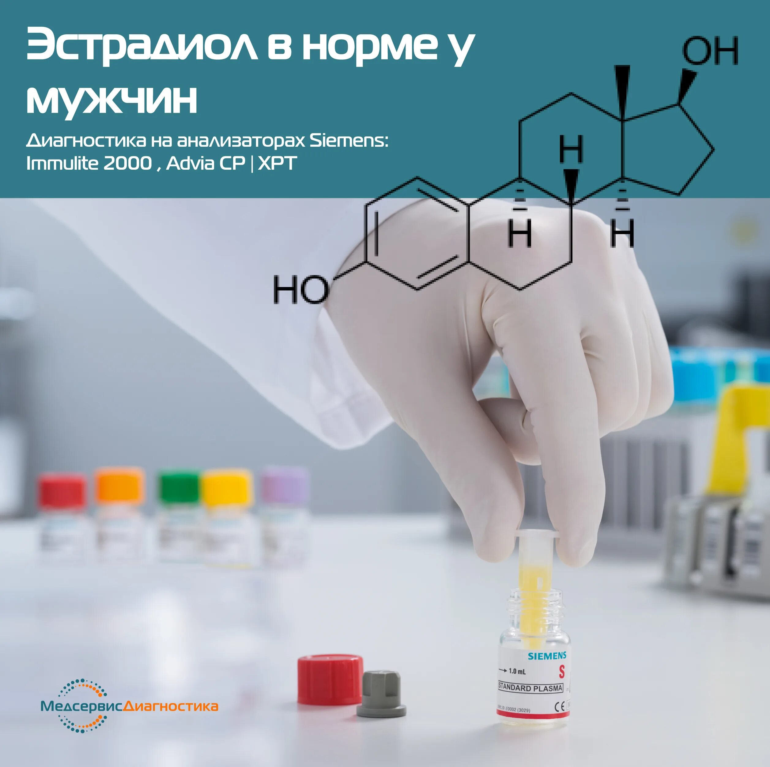 Повышенный эстрадиол. Эстрадиол. Эстрадиол гормон. Эстрадиол стероидный гормон. Эстрадиол у мужчин.