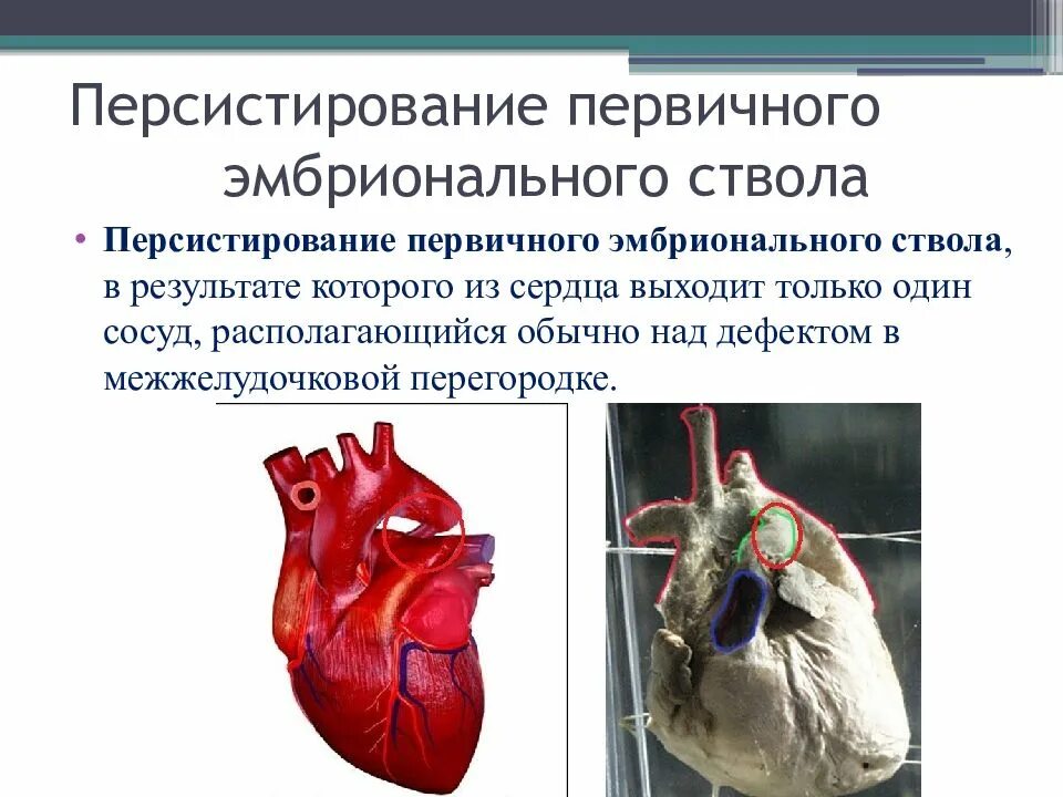 Персистирование. Персистирование примеры. Персистировании эмбриональных структур,. Формы персистирующей инфекции. Персистирование.