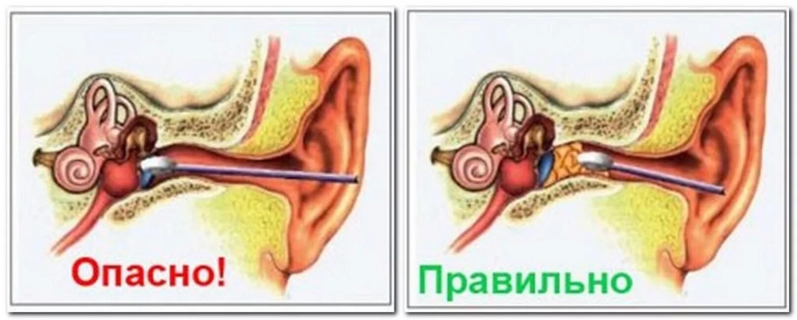 Как чистить пробку