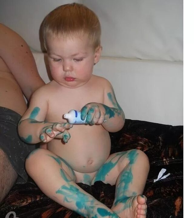 Зеленка. Китайская бесцветная зеленка. Можно использовать просроченную зеленку. Можно использовать просроченную зеленку. Обработка шва бриллиантовый зеленый.