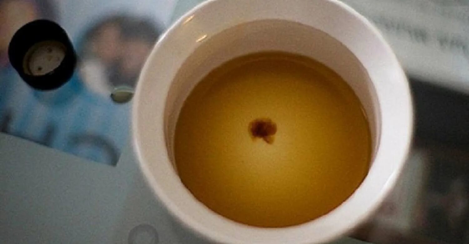 Как проверить тест на беременность йодом. Текст на беременность с йодом. беременность йод и моча. тестна беременность с йодом.