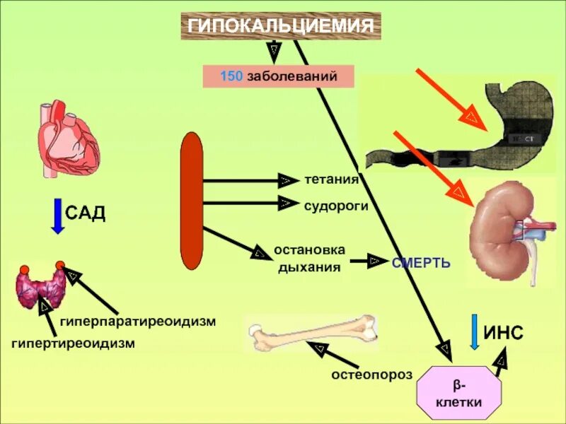Гипокальциемия что это. Гипокальциемия тетания механизм. проявления гипокальциемии. гипокальциемический синдром. гипокальциемия причины.