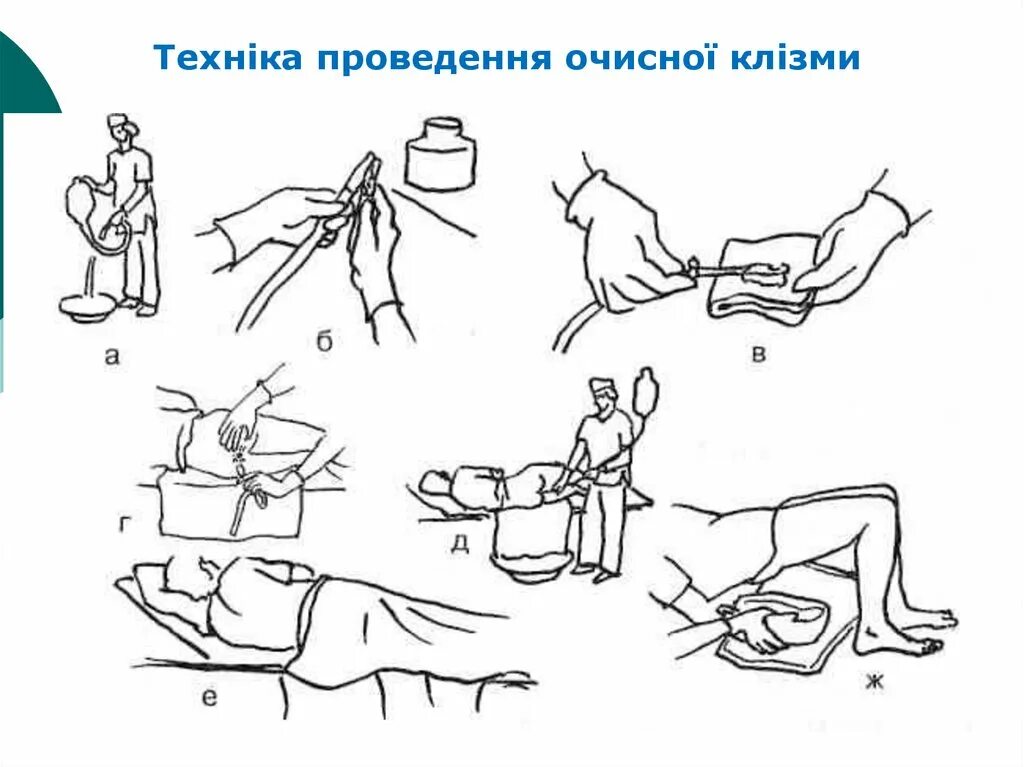 Техника промывания желудка