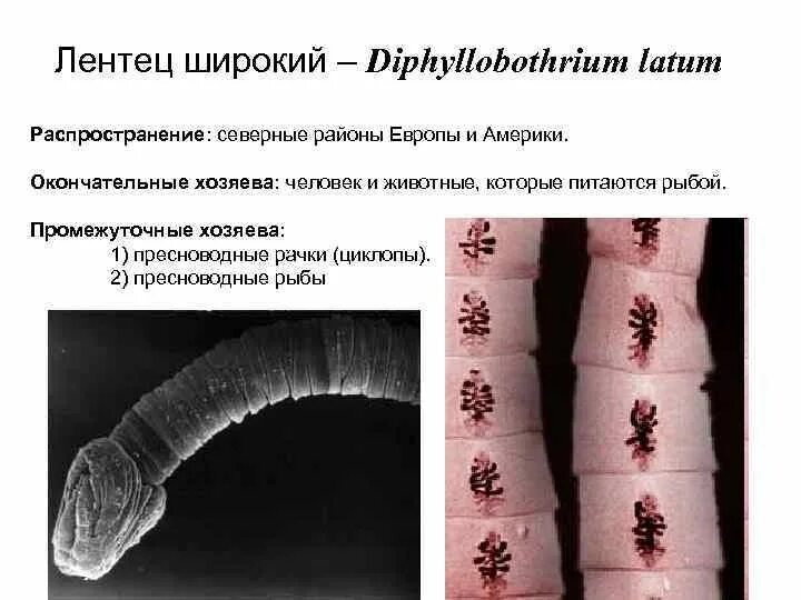 Широкий лентец какой. Лентец широкий возбудитель. широкий лентец (diphyllobothrium latum). diphyllobothrium latum промежуточный хозяин.