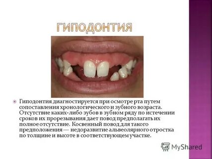 Отсутствие каких либо