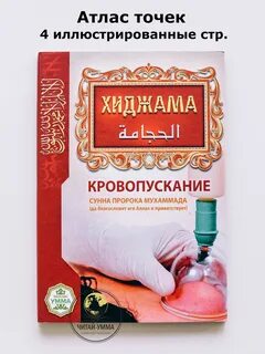 Хиджама пророк