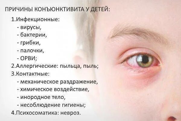 Коньюктивит у ребенка 6 лет. Конъюнктивит у дошкольника причины. Симптомы конъюнктивита у детей в год. Психосоматика болезни глаз конъюнктивит. Конъюнктивит психосоматика у ребенка.