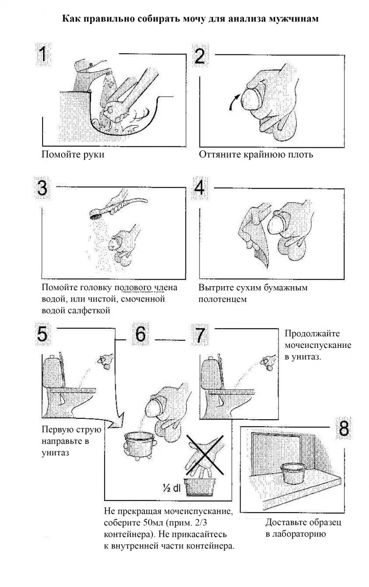Как правильно собрать утреннюю мочу. Как правильно сдавать общий анализ мочи. как собрать анализ мочи. как правильно собирать мочу при беременности на общий анализ. как сдавать кал на анализ.