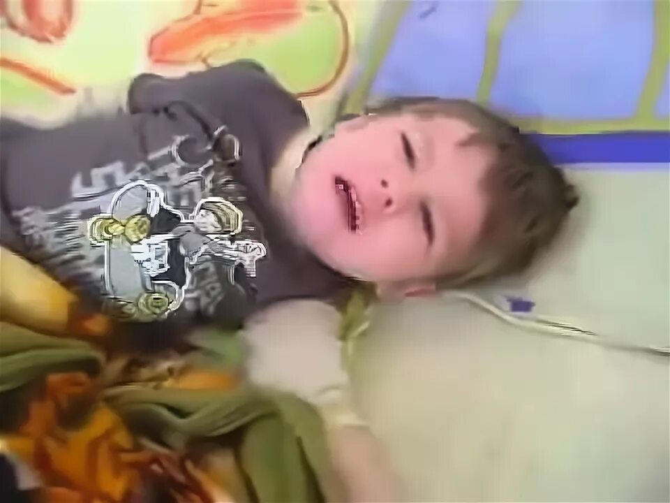 Эпи приступ у ребенка как выглядит Ракитин Б.В. Краткое изложение статьи: Quitadamo P, et al. Esophageal pH-impedan