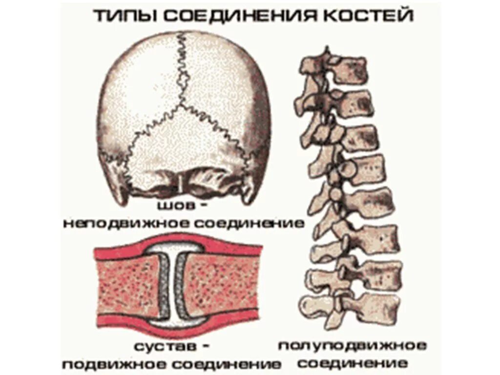 Неподвижное соединение человека. Типы соединения костей скелета. Неподвижный Тип соединения костей. Типы соединения костей человека. Неподвижное соединение костей.