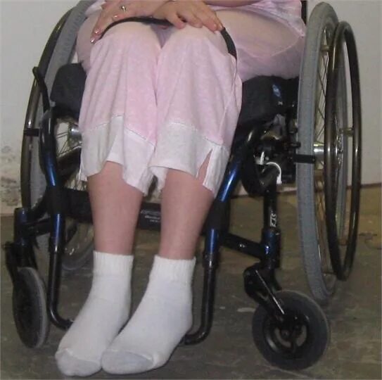 Инвалиды уроды. Ноги в инвалидной коляске. Ножки для инвалидной коляски. Ноги в коляске. Ноги инвалида на коляске.