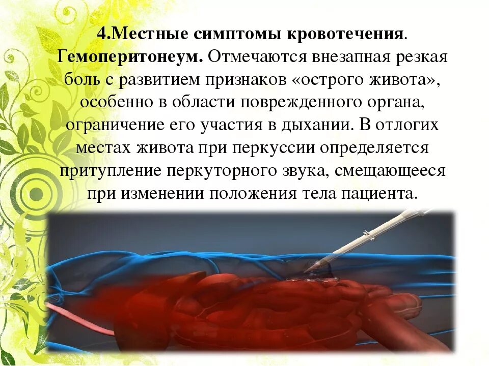Симптомы внутреннего брюшного кровотечения. Местные симптомы кровотечения. гемоперитонеум симптомы. клинические проявления гемоперитонеума.