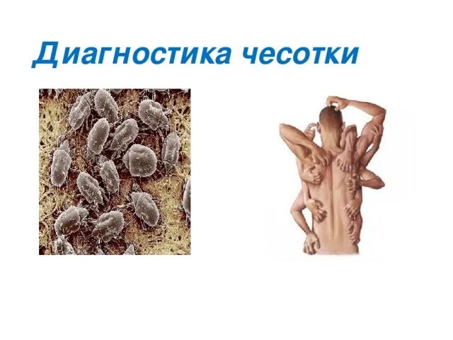 Чесотка биология 8 класс: найдено 86 картинок