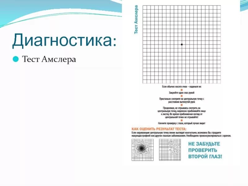 Тест на зрение амслера. Самоконтроль по тесту амслера. макулодистрофия тест амслера. тест офтальмолога амслера. сетка амслера тест.