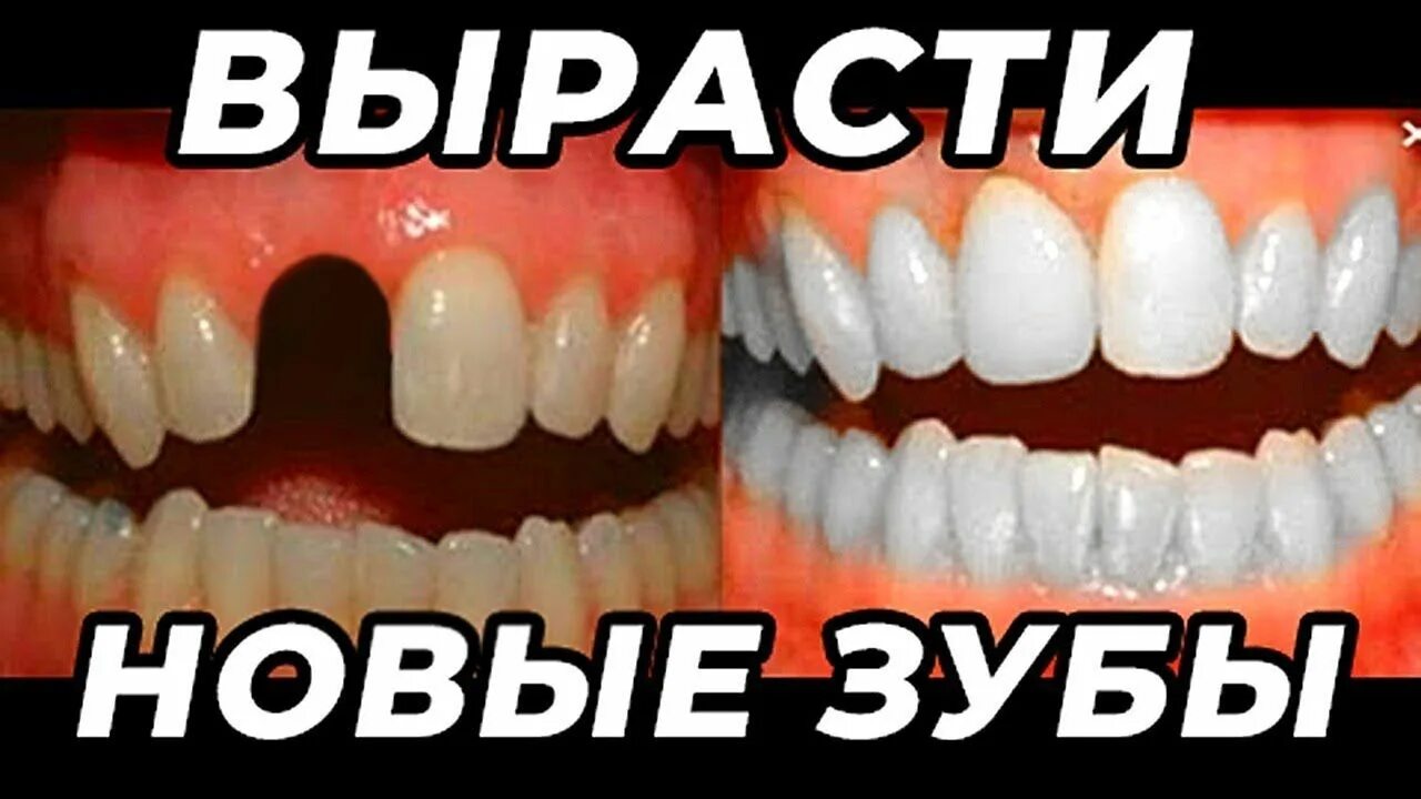 Искусственные зубы. Вырастить зубы. Зубы новейшие технологии. Научились выращивать зубы. Вырастить зубы.