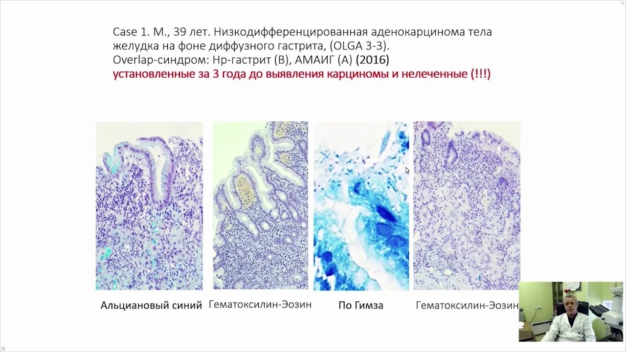 Национальный центр клинической морфологической. Морфологическое исследование биоптатов. Биопсия с морфологическим исследованием. Морфологическое исследование биоптата желудка. Морфологическое исследование биоптата мочевого пузыря.