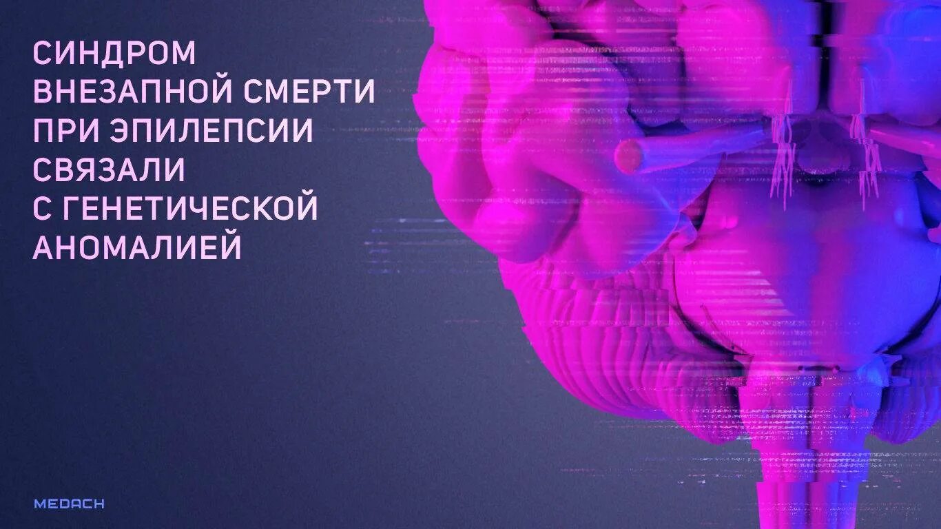 Лазерный эпилепсия