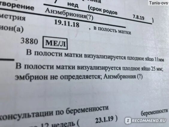 Беременная сучка не прочь быть без лифчика
