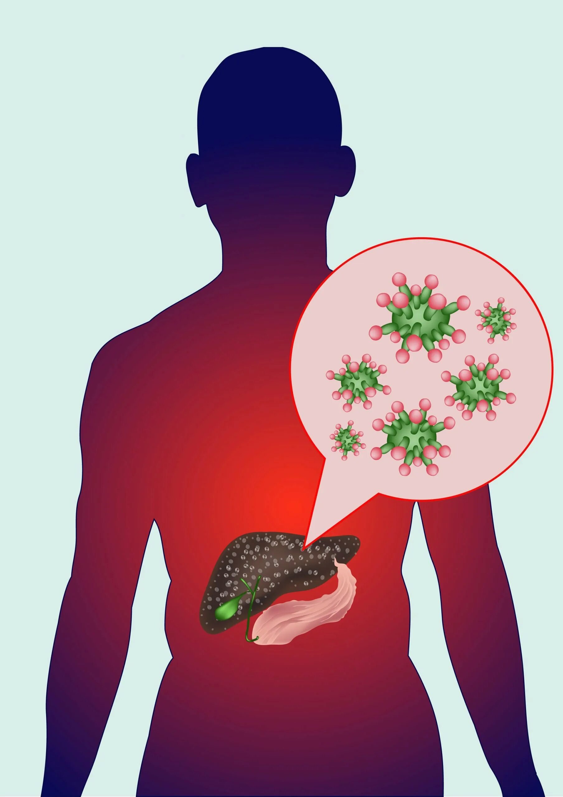 Гепатит рисунок. Вирусный гепатит печень.