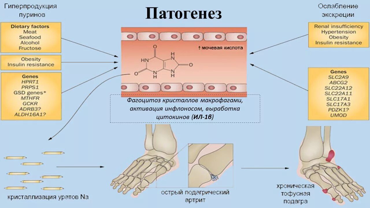 Мочевая кислота повышена суставы