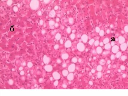 Жыныс 22 жаста тұрмыстық емес