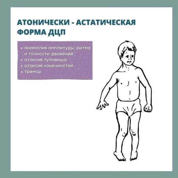 Дцп атонически астатическая. Формы ДЦП атонически-астатическая форма. Атаксическая форма ДЦП У детей. Мозжечковая форма ДЦП. ДЦП атонико-астатическая форма симптомы.