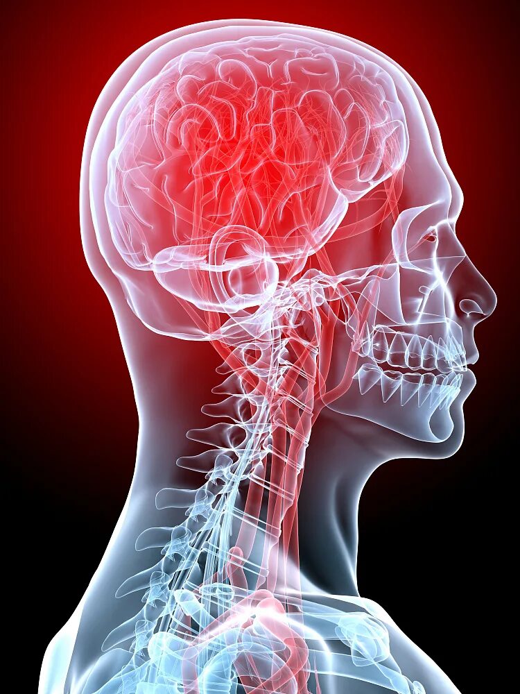 Заболевания головного мозга. Нервная система головы. Поражение нервной системы. Нарушение ЦНС. Симптомы проблем с сосудами головного