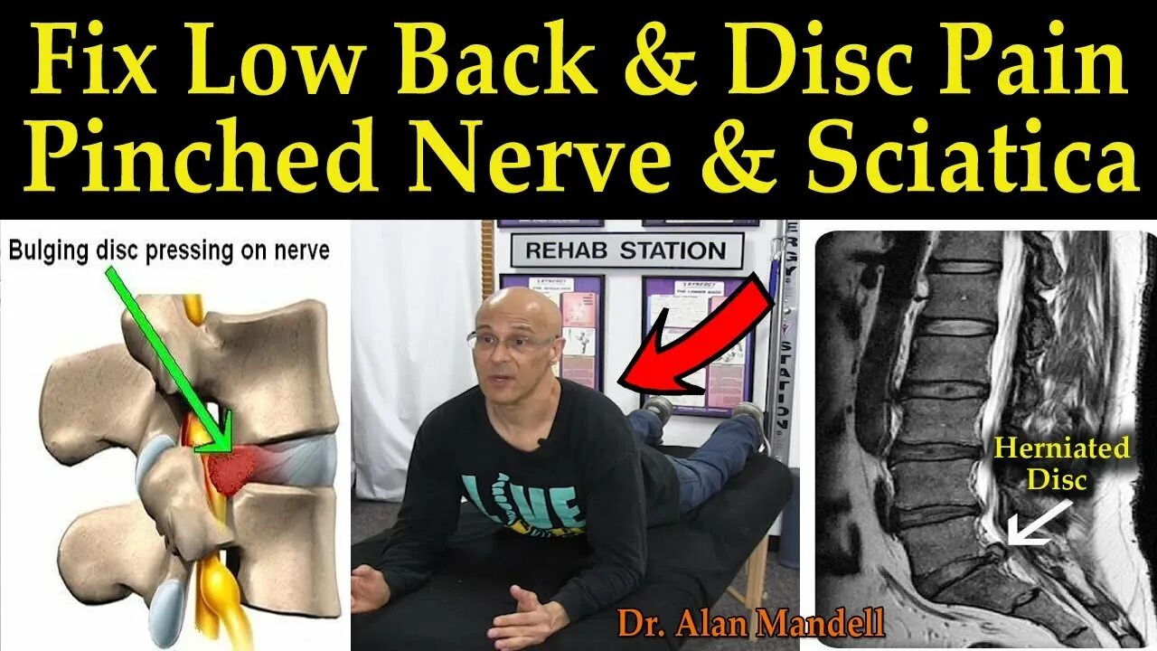 Disc bulging back Pain. How to Fix lower back Pain. Sciatica Relief and treatment of Pain Arthritis,back Pain, Leg Pain Neck Pain, herniated Disc Repair. Fix low