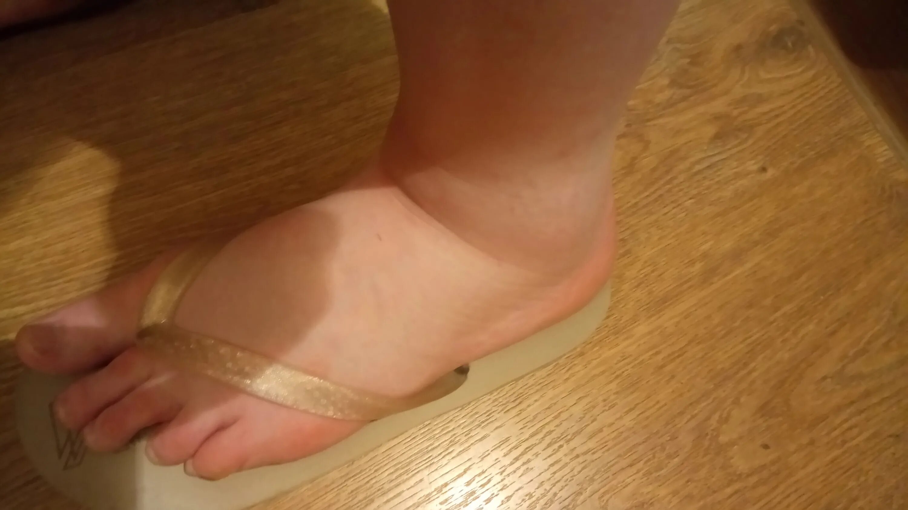 подвернул ногу болит щиколотка